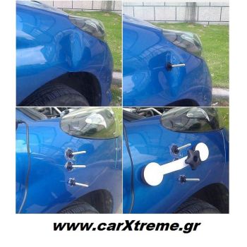 Σετ Επιδιόρθωσης Βαθουλωμάτων Αυτοκινήτου - Pops - a - Dent 18487
