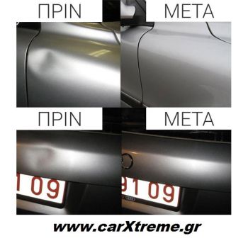 Σετ Επιδιόρθωσης Βαθουλωμάτων Αυτοκινήτου - Pops - a - Dent 18487